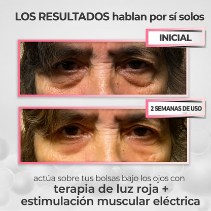 Reductor de Ojeras y Bolsas – Luz Roja y Microcorriente